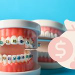 Biaya Pasang Behel di Jogja 2026