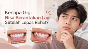 Gigi berantakan lagi setelah lepas behel